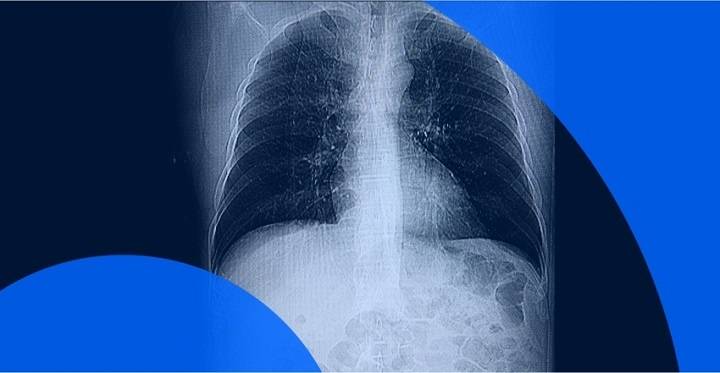 no news good news ct scan results